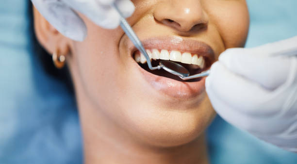 Best Emergency Cosmetic Dentistry in Spartanburg, SC